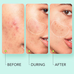 LitBear patch on forehead demonstrating discreet protection during daytime
