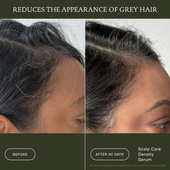 Living Proof before and after comparison illustrating increased visible hair density