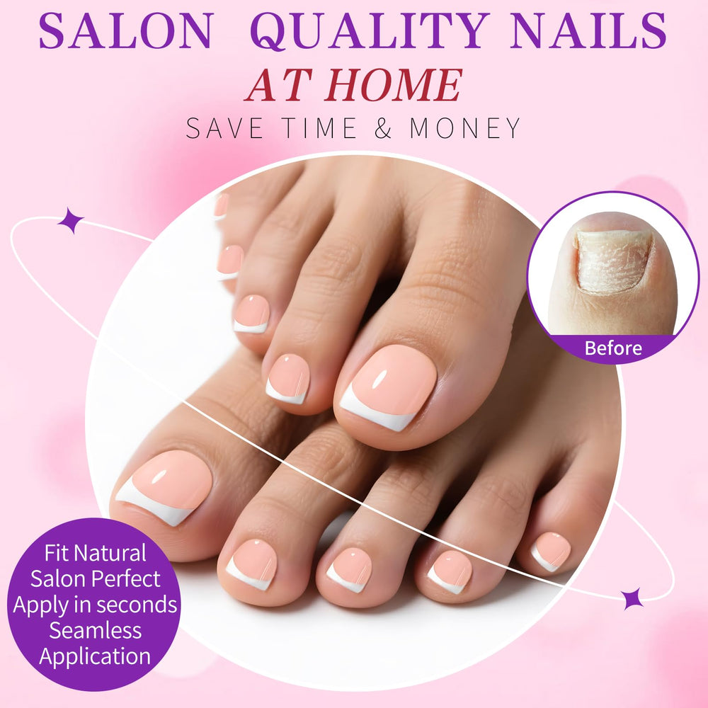 LoveOurHome toenail next to coin for scale to show short square length and proportions