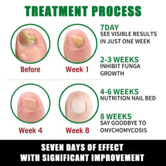 LOYOTICE in-use massage on cuticle before and after to show improved hydration