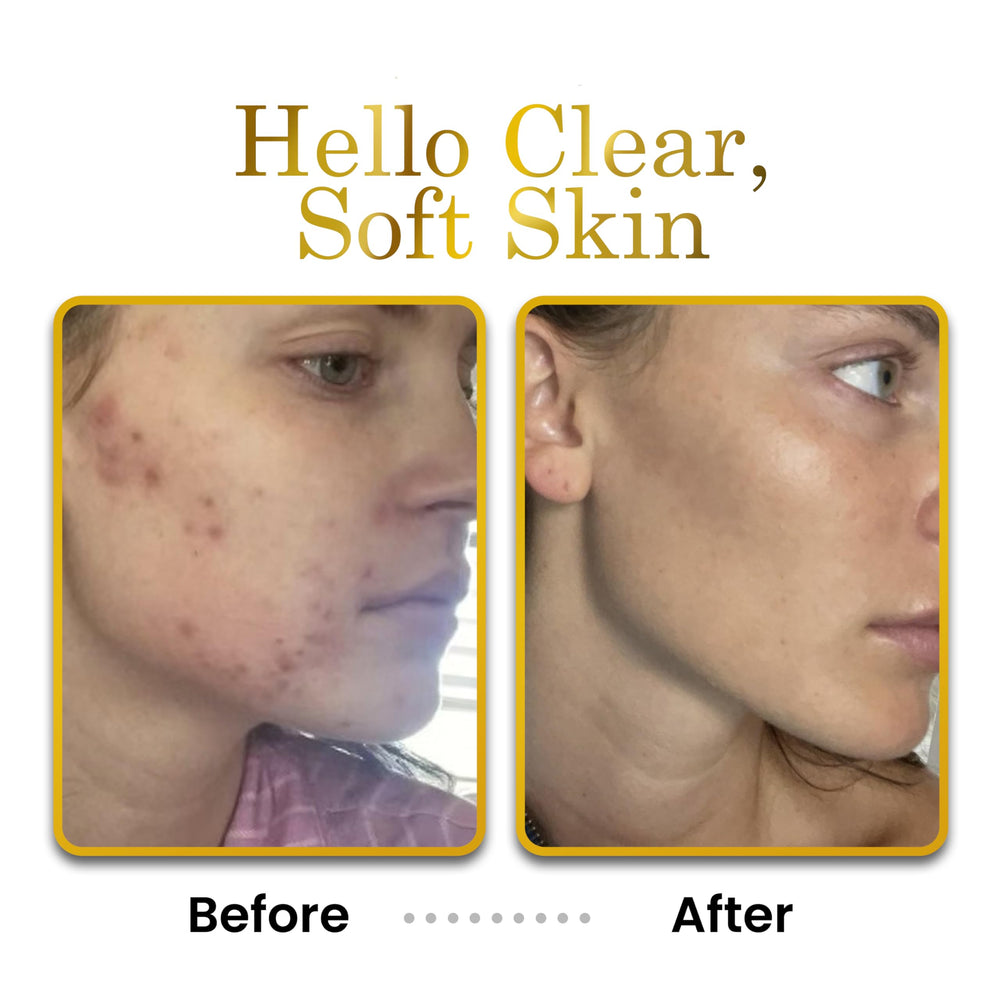 Luxe Beauty applied to hands to relieve dryness and improve skin softness