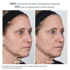 m-61 ingredient label close-up highlighting glycolic and salicylic acids and soothing extracts
