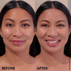M. Asam before and after portrait showing reduced redness and spots