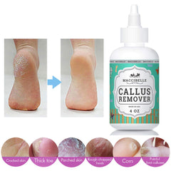 Maccibelle gel applied to heel close-up demonstrating targeted softening benefit