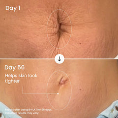 MAËLYS application on belly demonstrating smooth spread and targeted coverage