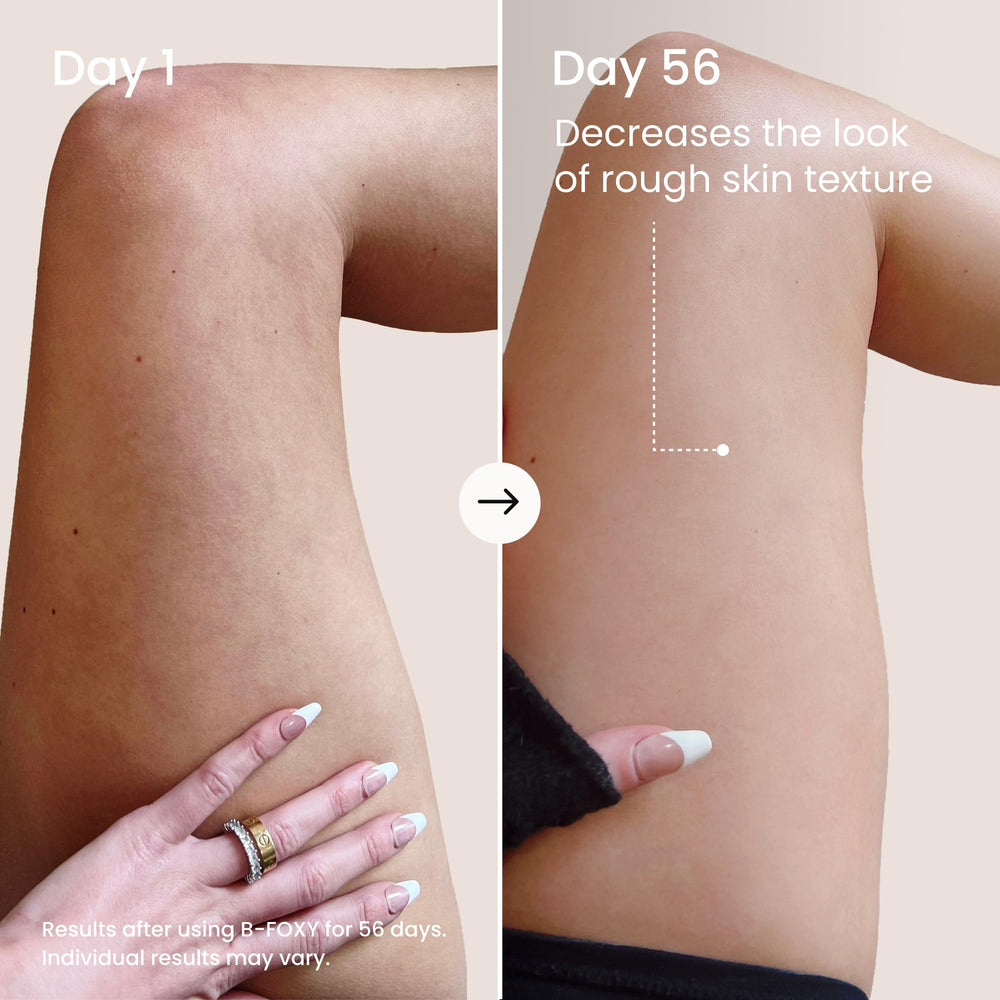 MAËLYS applied to inner thigh demonstrating non-greasy comfort