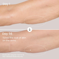 MAËLYS before and after thighs visualizing improved-looking texture and softness