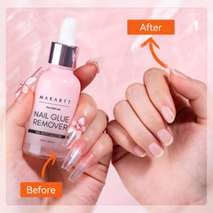 Makartt kit used in hand-care setting showing gentler at-home removal