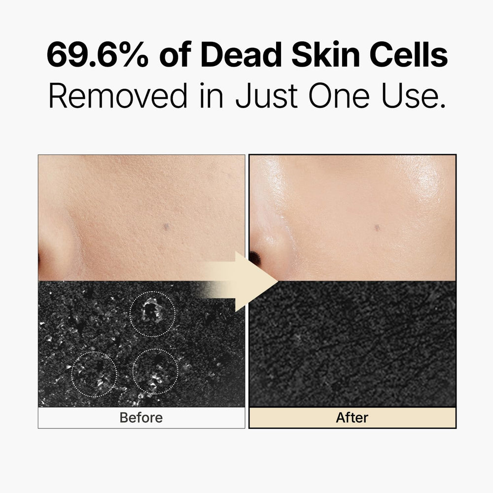 ma:nyo rice enzyme ingredient visual emphasizing natural enzyme exfoliation