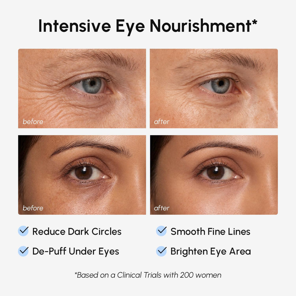 MAREE patch applied under eye demonstrating discreet fit and immediate depuffing benefit