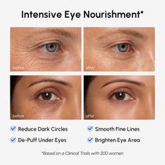 MAREE patch applied under eye demonstrating discreet fit and immediate depuffing benefit