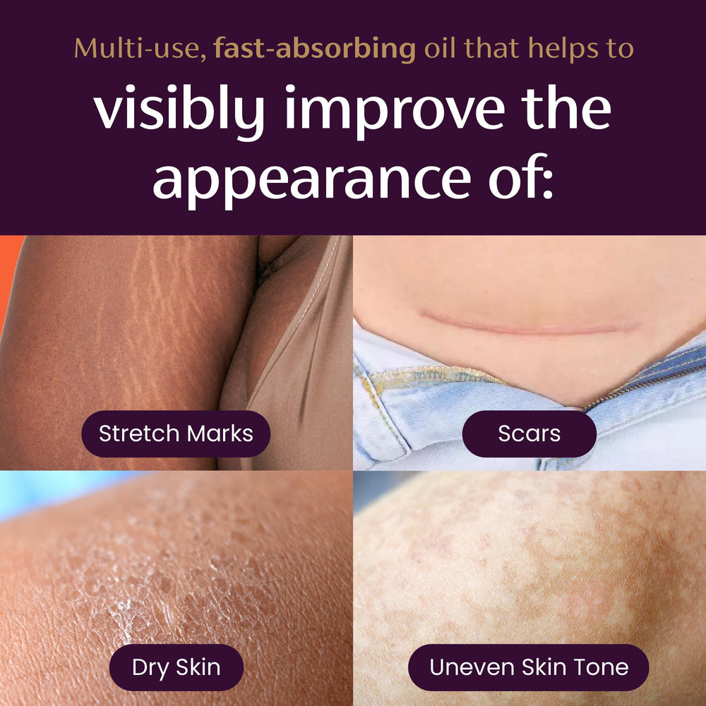 Close-up of Mederma label and ingredient list showing transparency and paraben-free formula