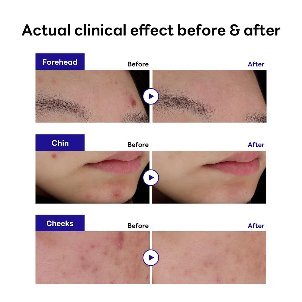 MEDIHEAL single patch close-up highlighting thin profile and discreet finish for wearing