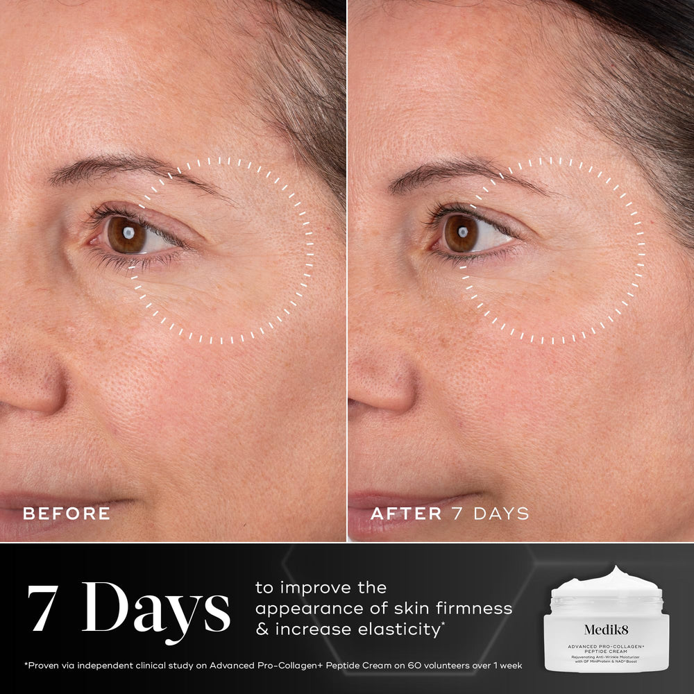 Medik8 cream on fingertip demonstrating easy spreadability and immediate hydration benefit
