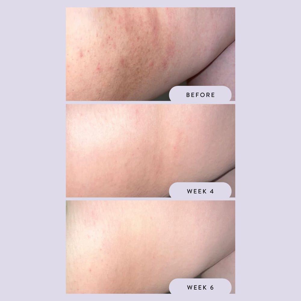 Megababe Night Rescue being applied to thigh for soothing and tone-evening benefits