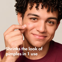 Mighty Patch close-up texture of hydrocolloid patch showing thin finish