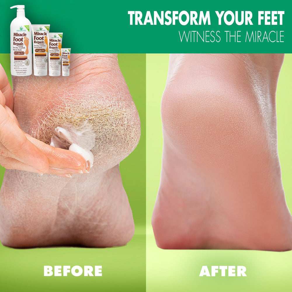Miracle of Aloe foot cream tube closeup highlighting applicator and texture