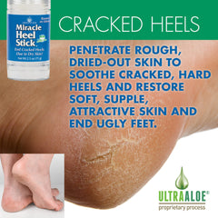 Miracle of Aloe foot repair cream tube front showing deep-hydration benefit