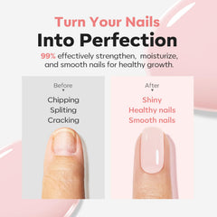 modelones before and after nail compare showing reduced discoloration and improvement