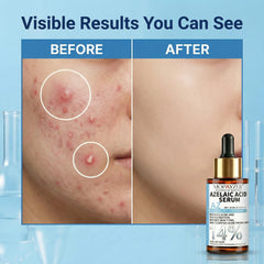 mopayzer serum drop on hand showing lightweight texture and quick absorption