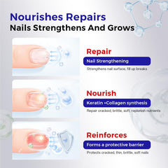 Morovan nail before and after demonstrating stronger appearance