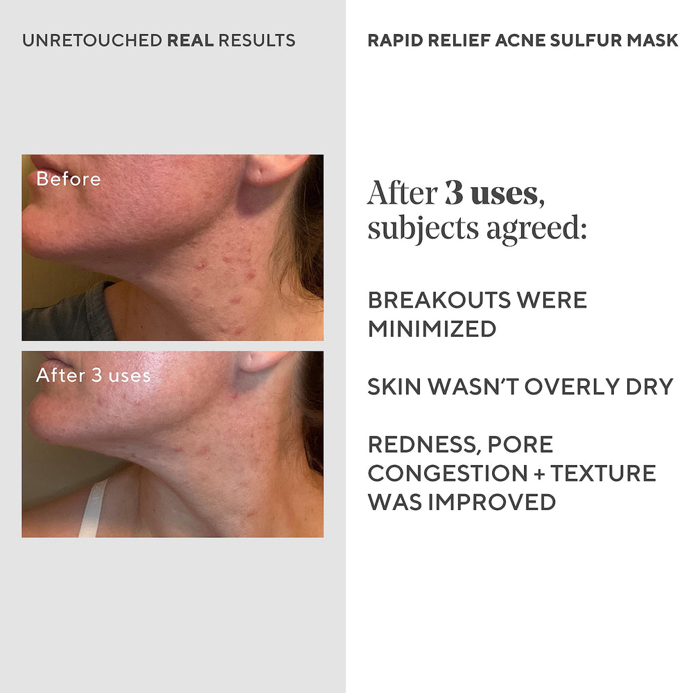 Murad rinsing step with water, illustrating gentle removal and comfortable finish