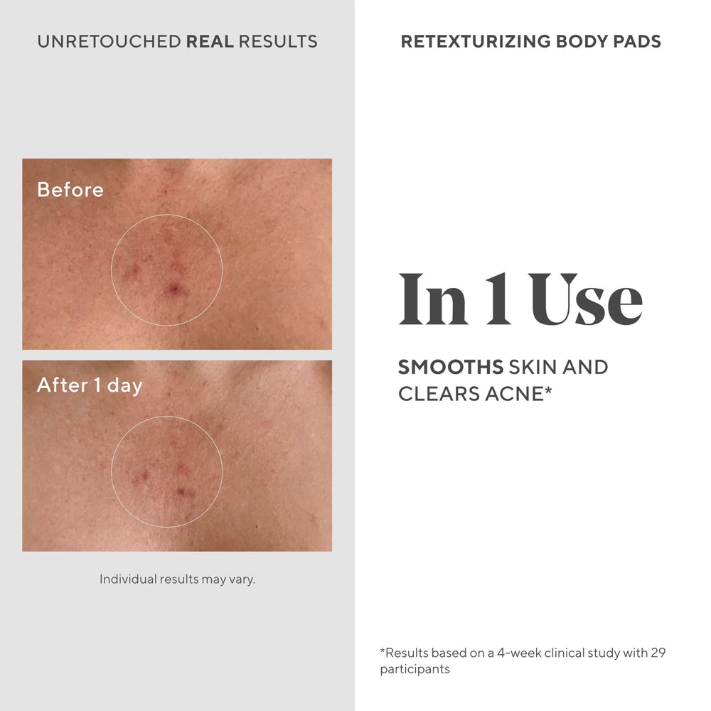 Murad pad in hand applying to skin for quick exfoliation