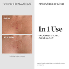 Murad pad in hand applying to skin for quick exfoliation