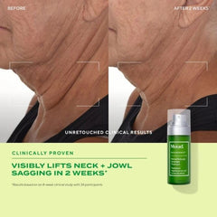Murad label and cap detail highlighting active encapsulated retinal