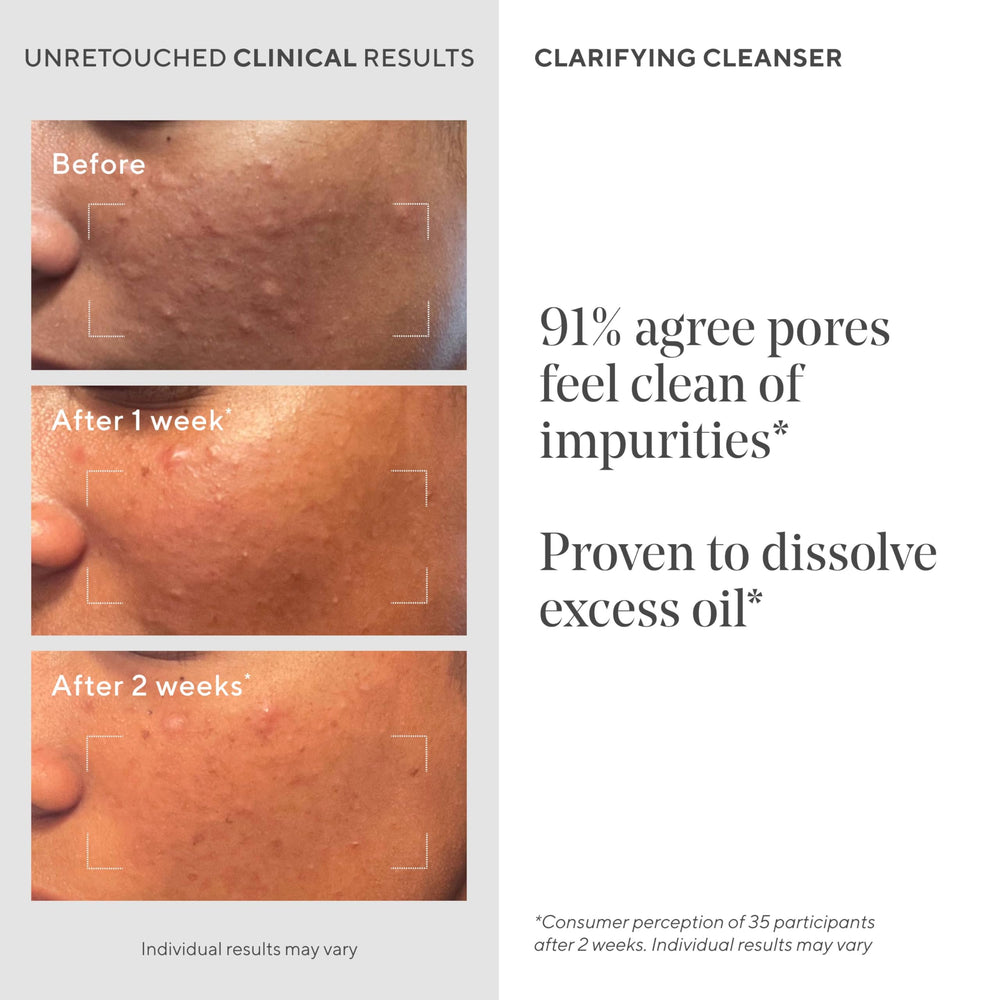 Murad salicylic acid ingredient visual highlighting pore-exfoliating benefit