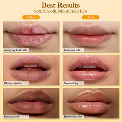 MUREND before and after lip comparison showing smoother, more even-looking lips