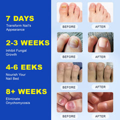 NADiminish patch on fingernail during sleep illustrating easy overnight care