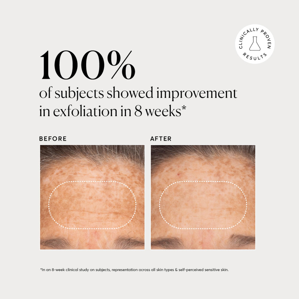 Naturium applied to hand showing even spread and gentle skin compatibility