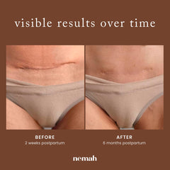 Nemah lifestyle postpartum use on bed showing easy twice-daily routine