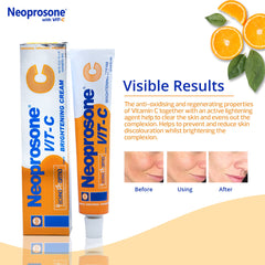Neoprosone cream on fingertip demonstrating easy application and targeted spot coverage