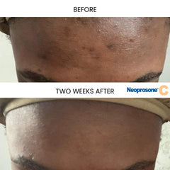 Neoprosone serum texture spread on skin, lightweight finish for quick absorption