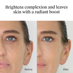 Neutrogena concealer dot on blemish demonstrating targeted coverage