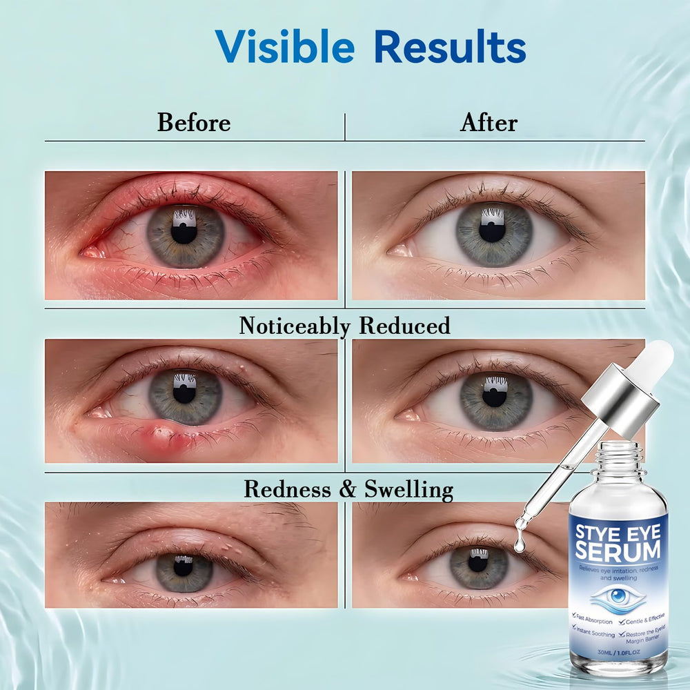 Nexkayee applying serum gently to eyelid highlighting targeted soothing benefit