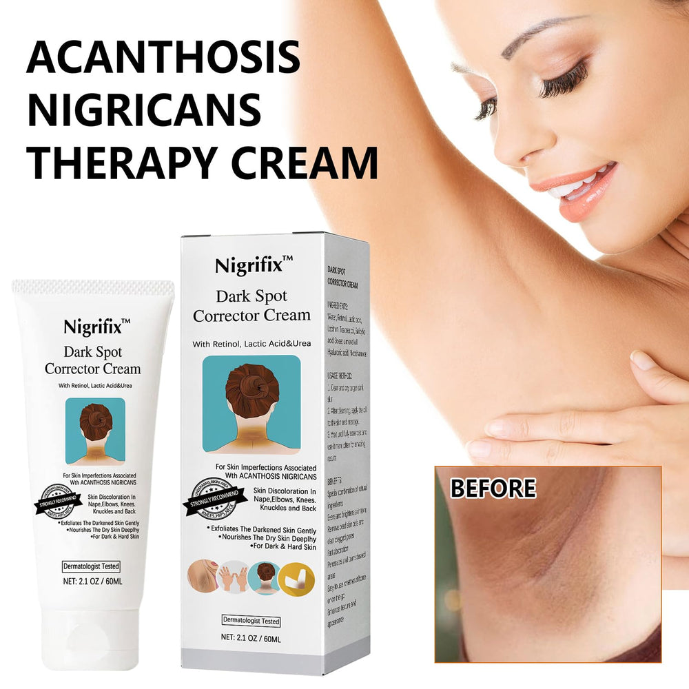 Nigrifix applied to underarm illustrating targeted dark-spot treatment benefit