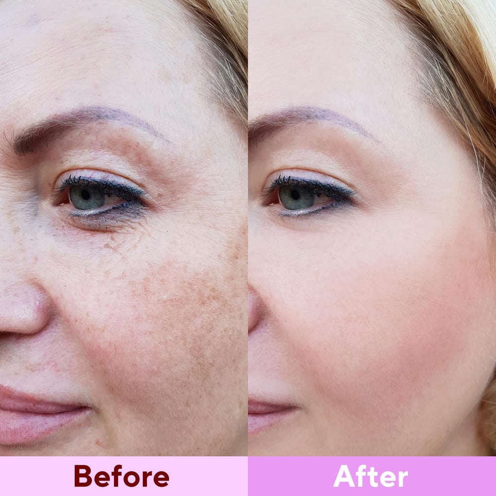 Nityrliv fresh skin morning after use showing firmer hydrated look