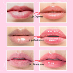NIYET patch applied to lips demonstrating secure fit and immediate soothing effect