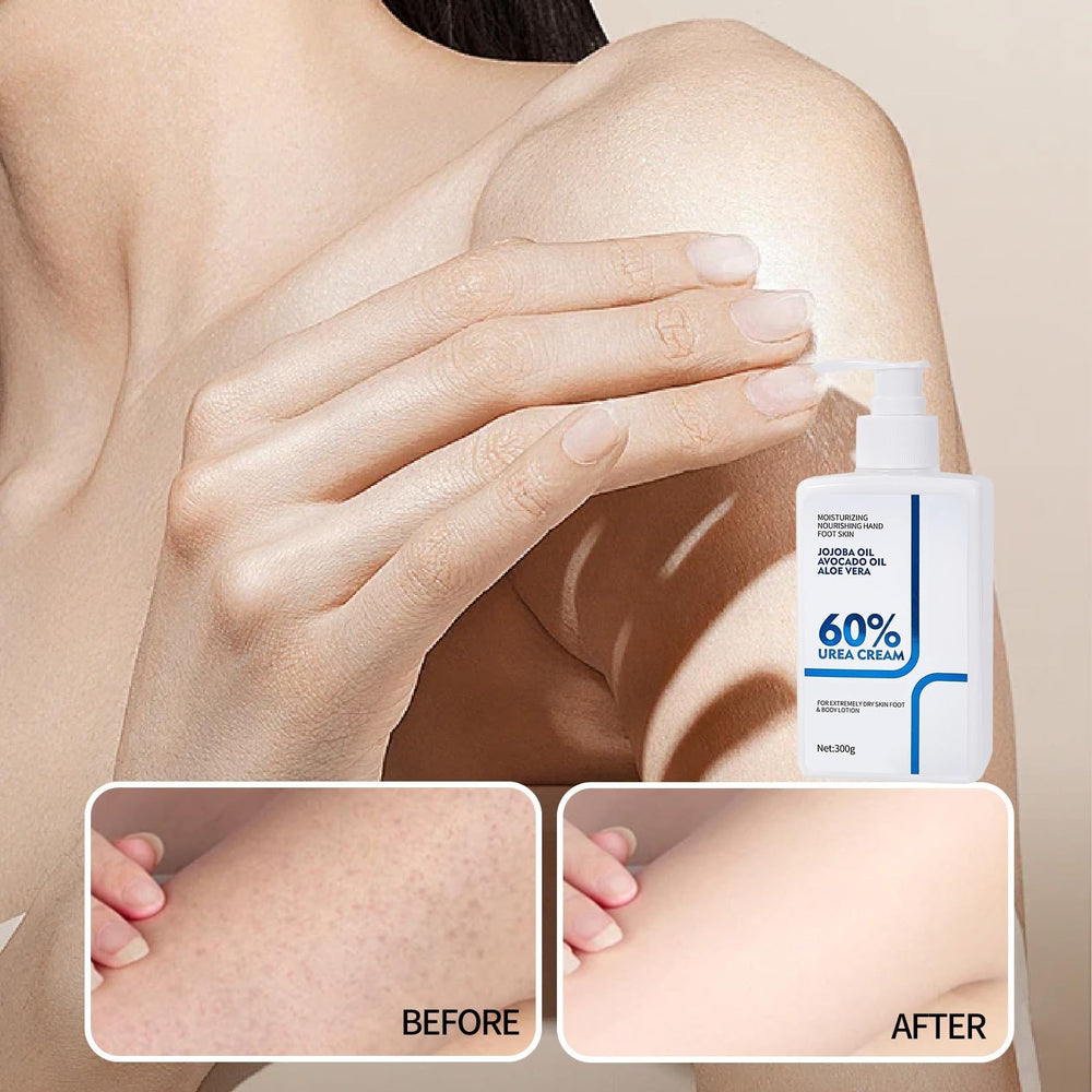 NIZENTA applied to heels showing moisturized softer feet benefit