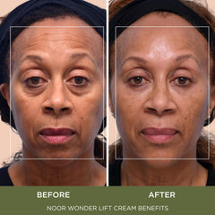 NOOR HAIR Syn‑Ake peptide ingredient display highlighting age-smoothing benefit