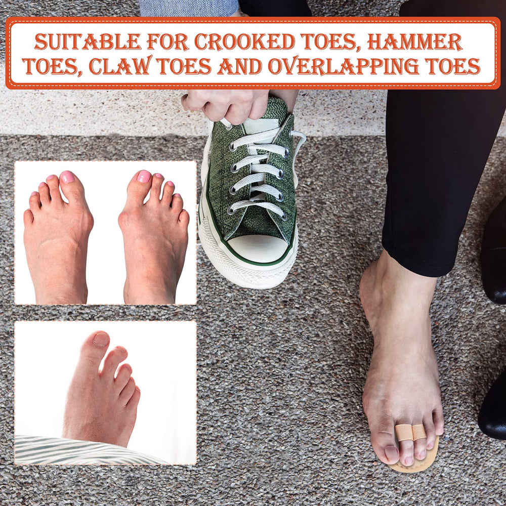 Nuanchu splint worn on foot in daily setting providing comfortable support
