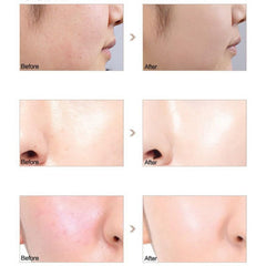 nvyue PHOERA next to ruler showing compact 18ml travel-friendly size