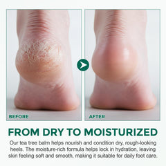 Nyloriaine ingredient layout with tea tree and aloe showing botanical benefit