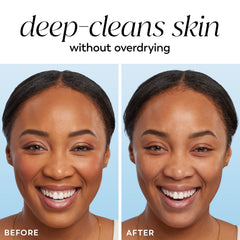 Olay rinsed face after use showing refreshed, soft skin appearance