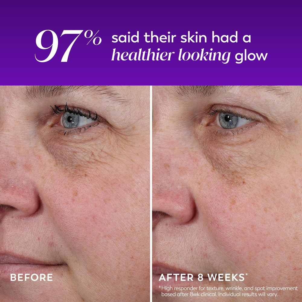 Olay product being applied at night demonstrating simple bedtime skincare step