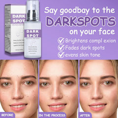 OMYIJVS applied on hand demonstrating targeted spot treatment and visible blending