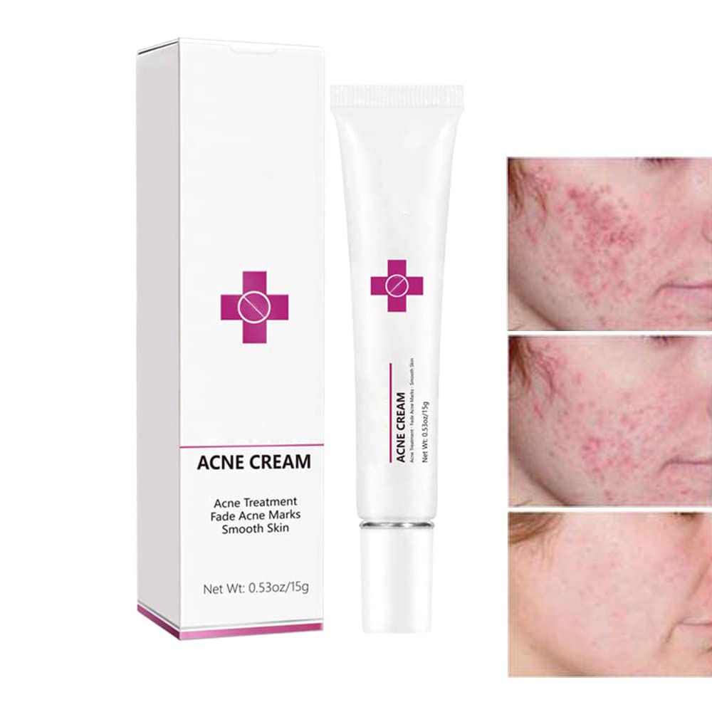 Onkessy front packaging showing product and clear instructions for quick use benefit